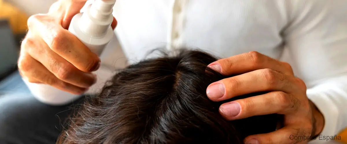 ¿Cómo se cura la dermatitis seborreica en el cuero cabelludo?